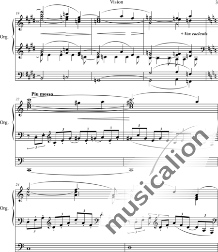 Dunham, Henry M.: Vision - Organ>wped:3