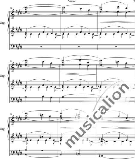 Dunham, Henry M.: Vision - Organ>wped:7